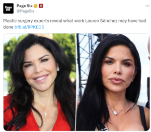 Has Lauren Sanchez Undergone Surgery? Get the True Story | Tilt Magazine